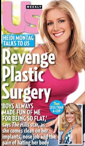 heidi montag plastic surgery face. Heidi Montag: Gone Too Far